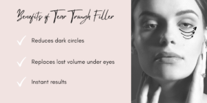 Tear trough filler infographic with all the benefits in York